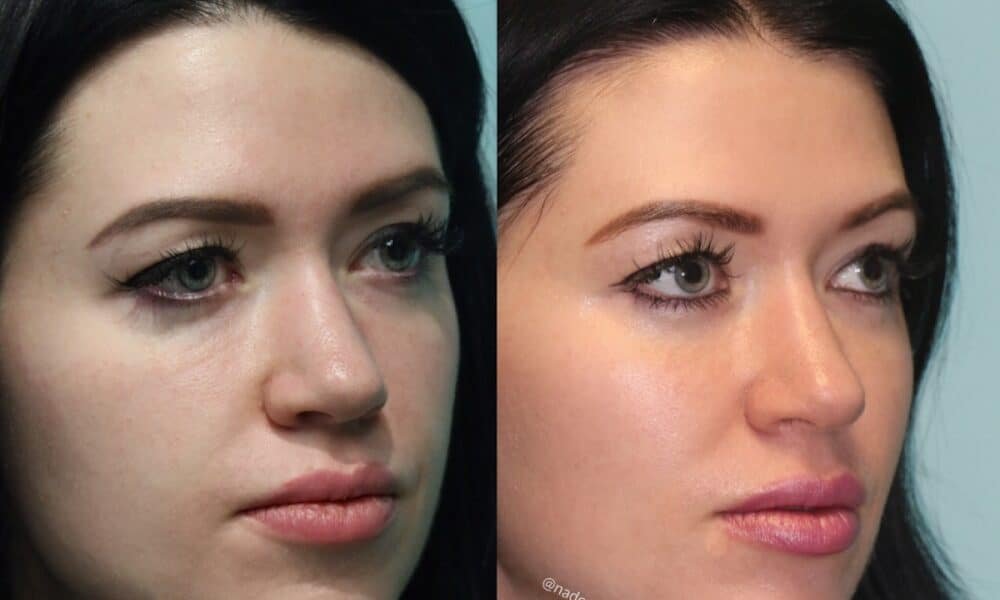 The Naderi Center for Plastic Surgery & Dermatology