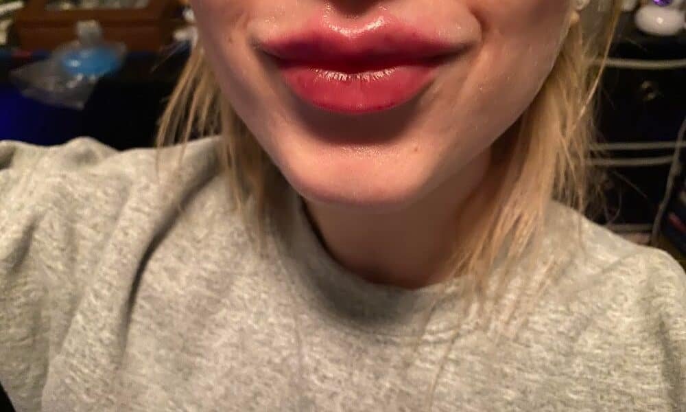 Center City Dermatology, LLC